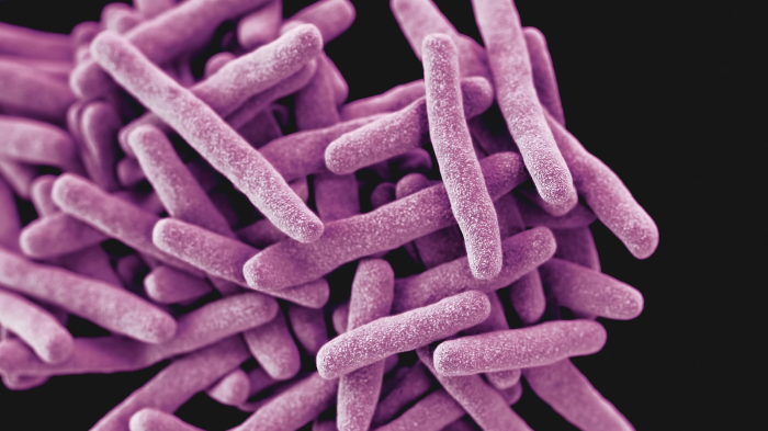 Bacterial infections, including streptococcus, staphylococcus, and tuberculosis 3