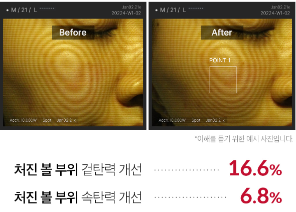 1회 사용으로 인한 피부 탄력 변화