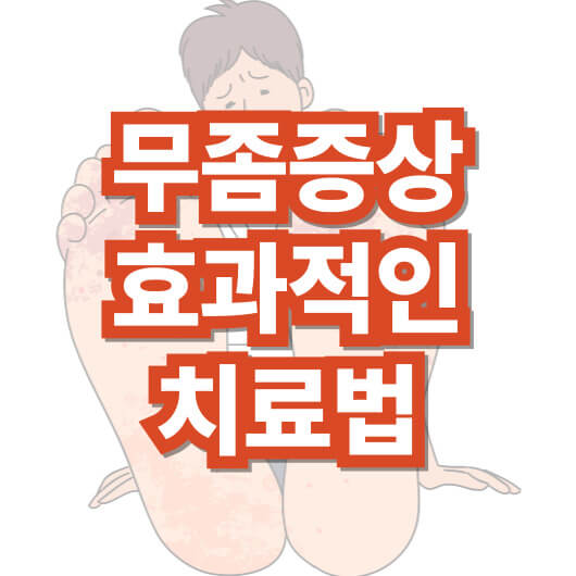 무좀-증상과-효과적인-치료법