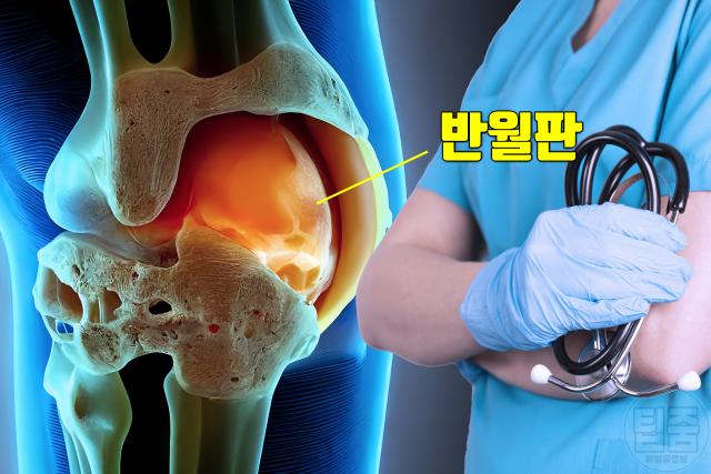무릎 뒤 통증 원인 반월판 파열