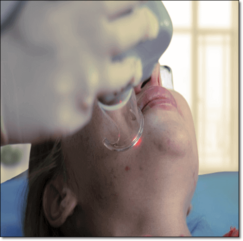 피부염이 심한 여성