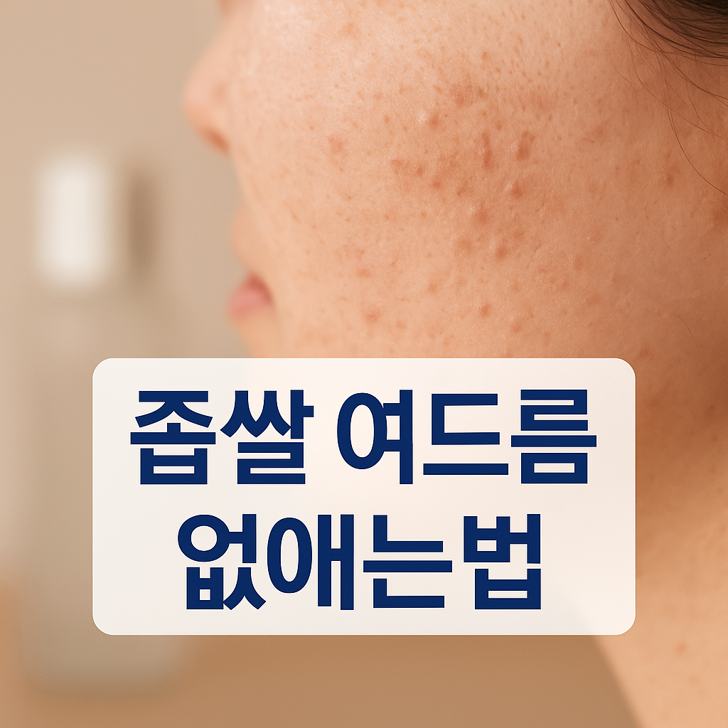 좁쌀 여드름 없애는법