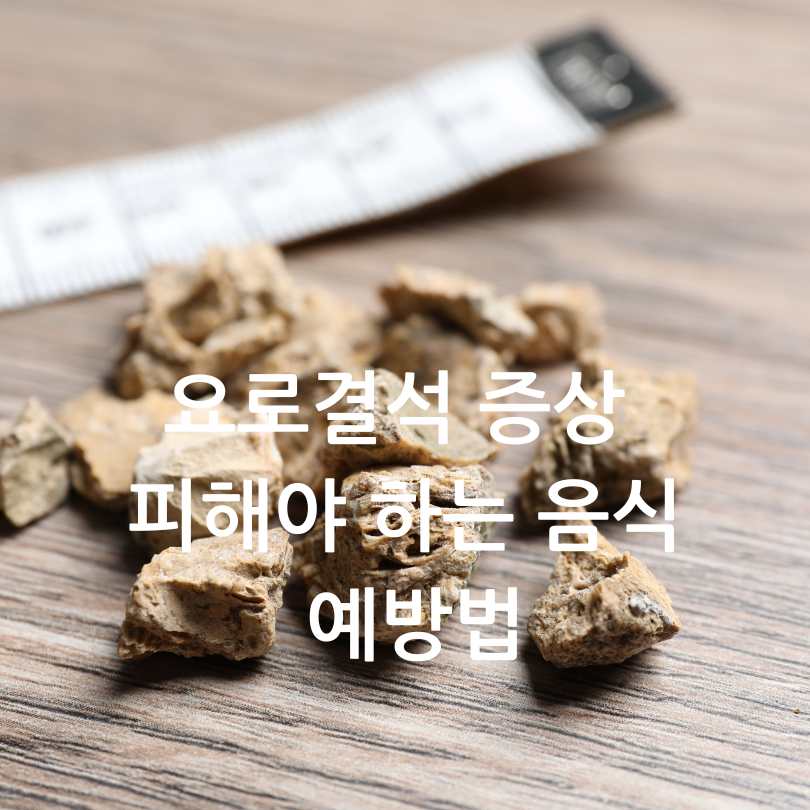 요로결석 증상과 피해야 하는 음식