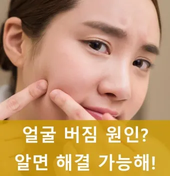 얼굴 버짐 증상 없애는 실전 방법 5가지 및 관리요령_12