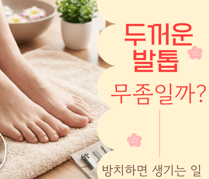 두꺼운 발톱