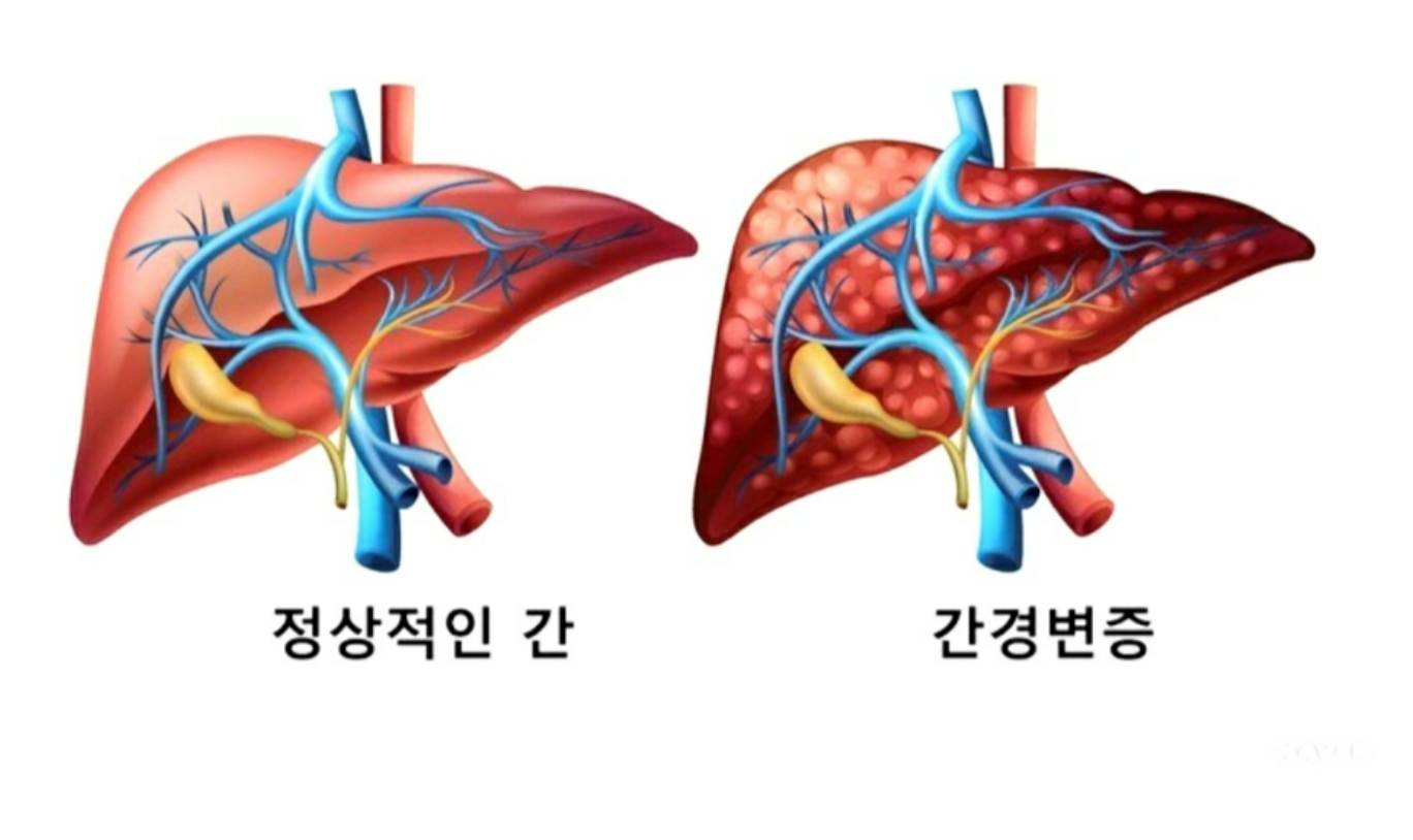 간에 상태 비교