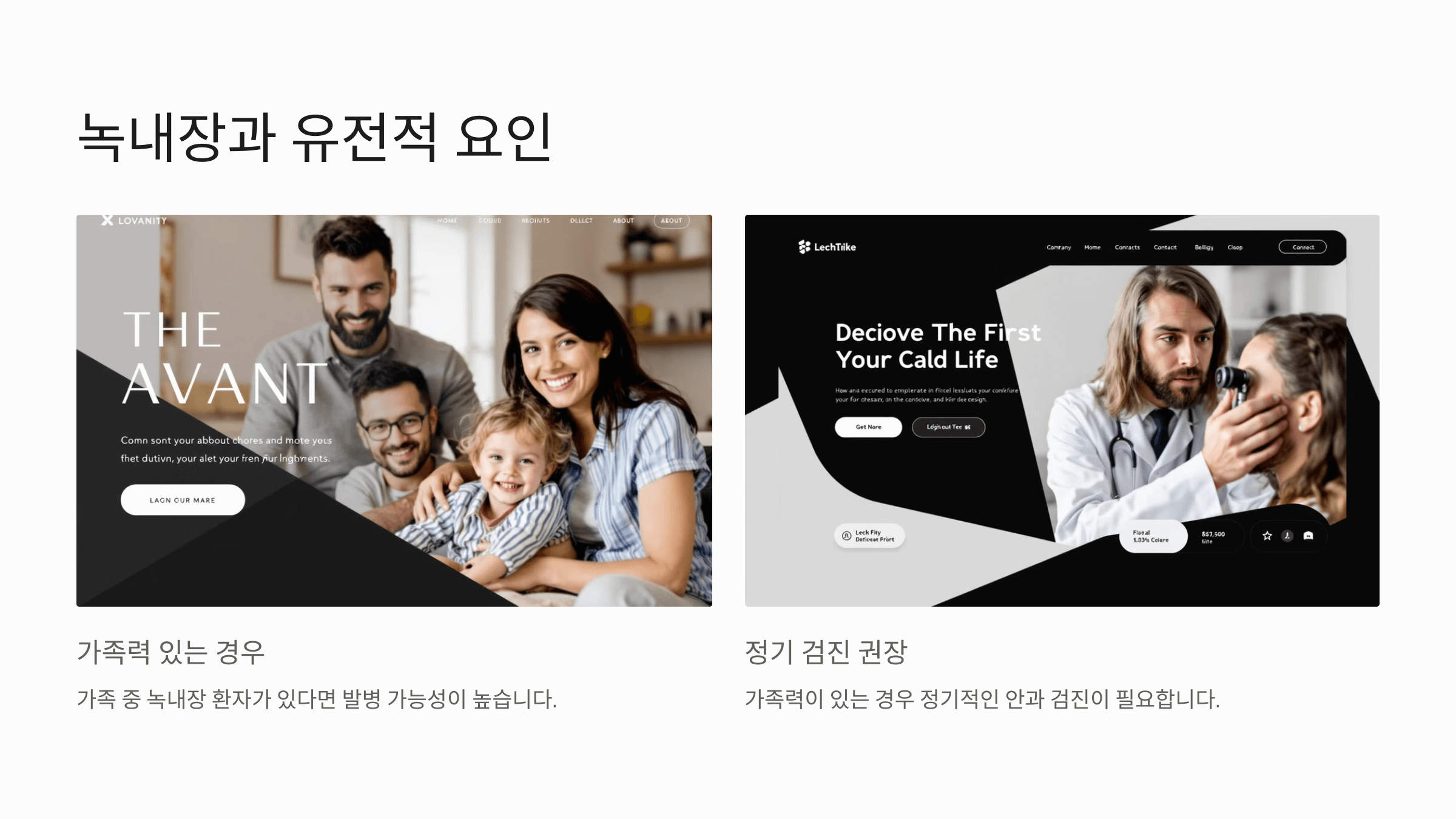 녹내장과 관련된 사진입니다.