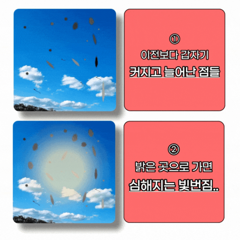 비문증영양제