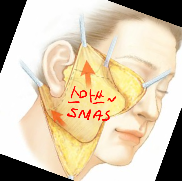슈링크 부작용 효과 가격 후기
