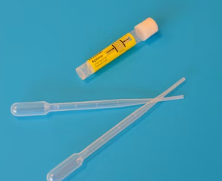 요실금 치료방법 진단 기준 합병증