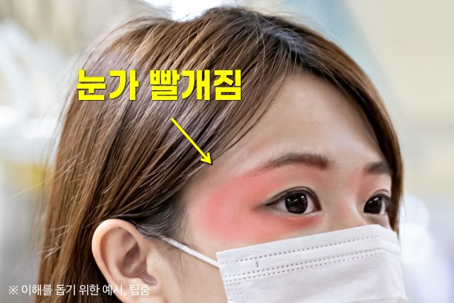 검정 마스크 자외선 차단, 눈 주위가 빨개지는 이유, 팁줌