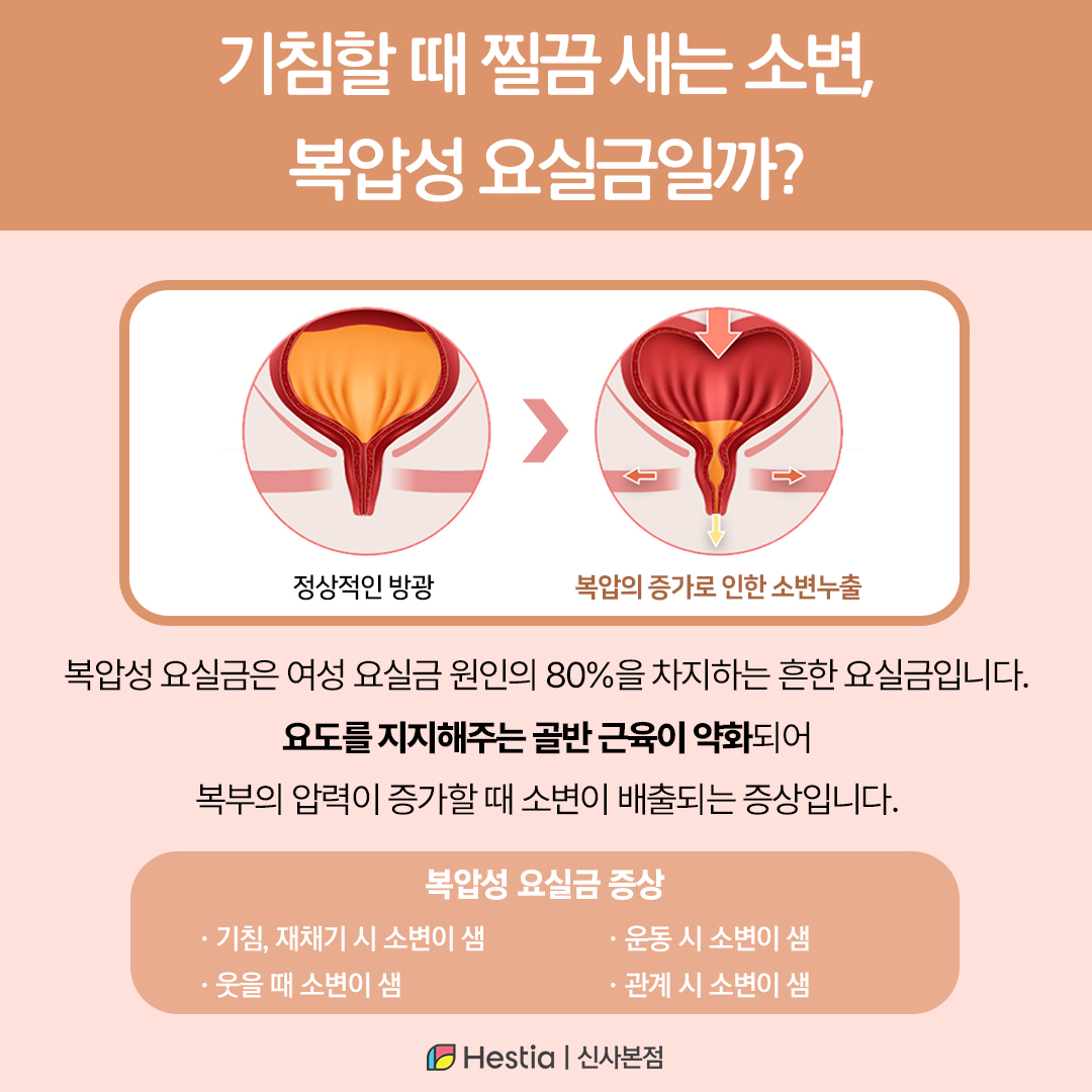 기침할 때 찔끔 새는 소변, 복압성 요실금일까?