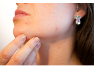 췌장암 초기증상 체력감소