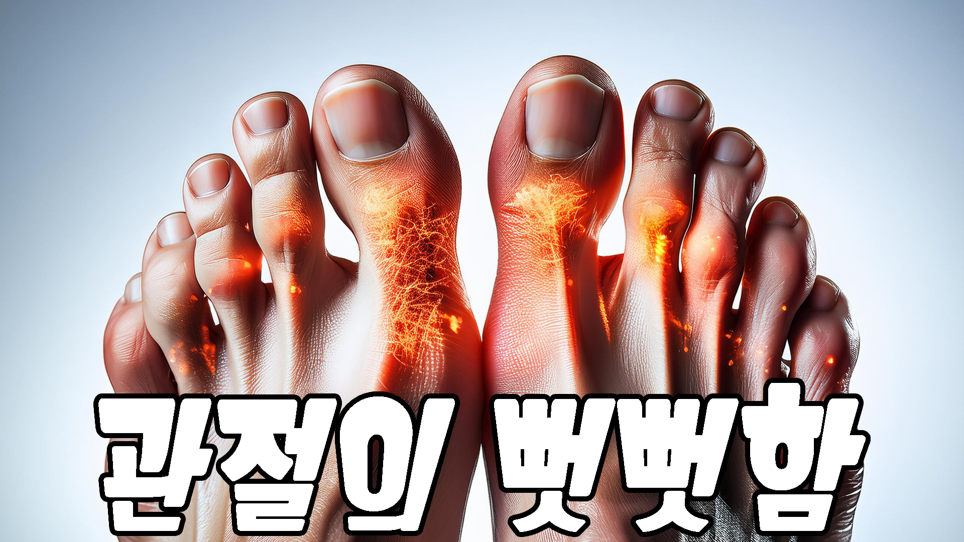 관절의 뻣뻣함