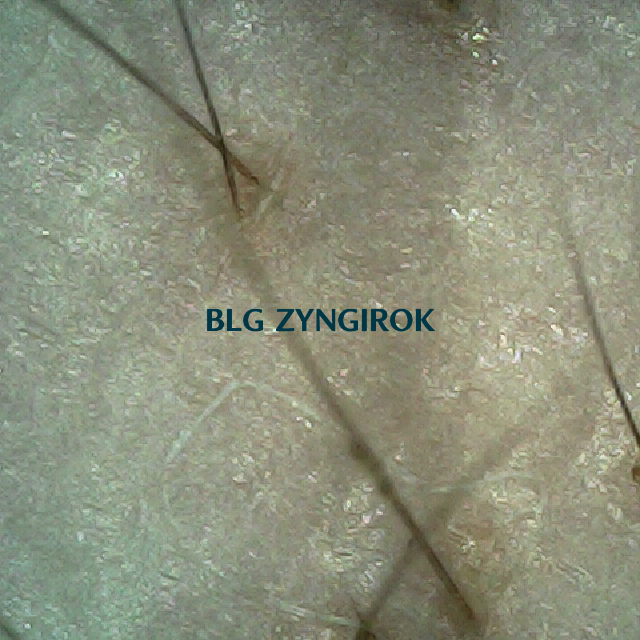 탈모 극복 프로젝트 - 오른쪽 M자 부위 두피 모습이다.