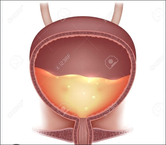 왼쪽 아랫배 통증 원인과 치료법