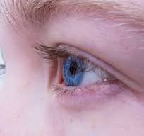 눈꺼풀 떨림 현상