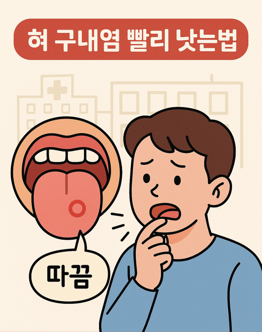 혀 구내염 빨리 낫는법과 입병 원인 총정리