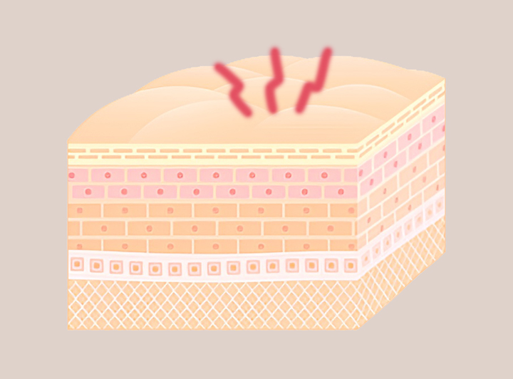 피부의-손상-모습