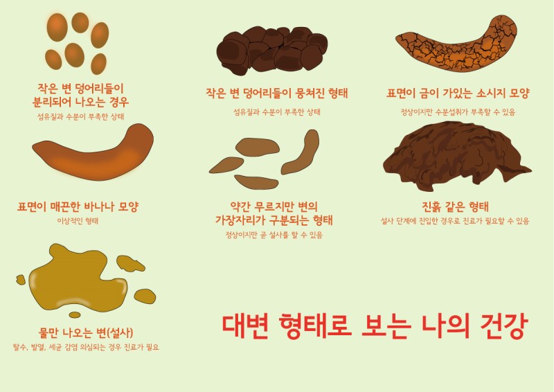 대변 색깔로 살펴보는 건강상태 5가지 녹색(초록색)&amp;#44; 검은색&amp;#44; 회색변&amp;#44; 흰색변