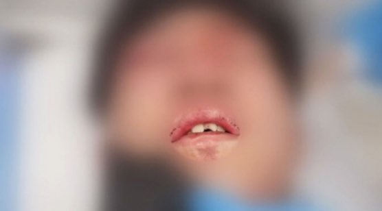 황영웅 피해자 인터뷰 내용