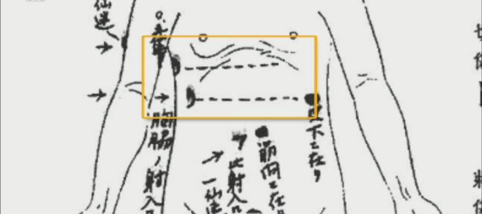 이토 히로부미 총상 부위