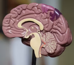 수면 부족이 우리 몸에 미치는 영향 경고 증상 치매