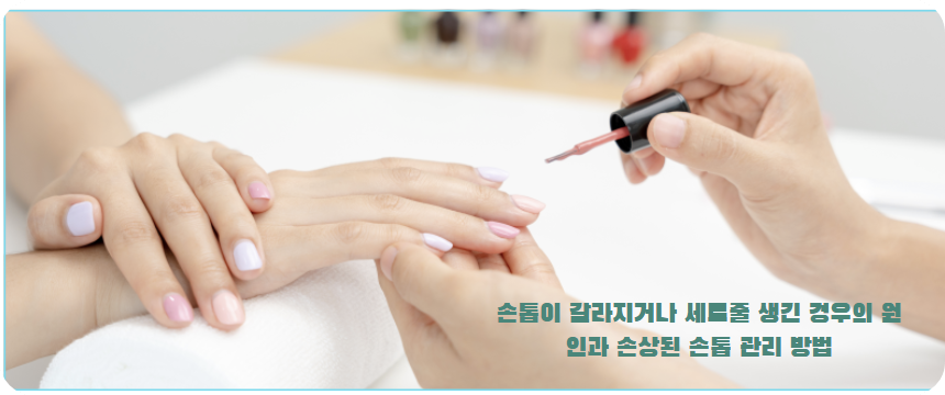 손톱이 갈라지거나 세로줄이 생기는 원인