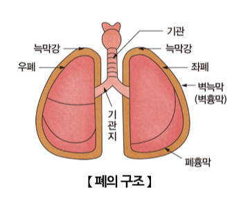 폐구조