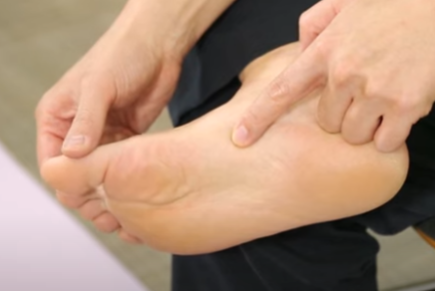 무지외반증 초간단 치료법&amp;#44; 무지외반증 교정기