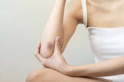 멍이 생기는 이유?