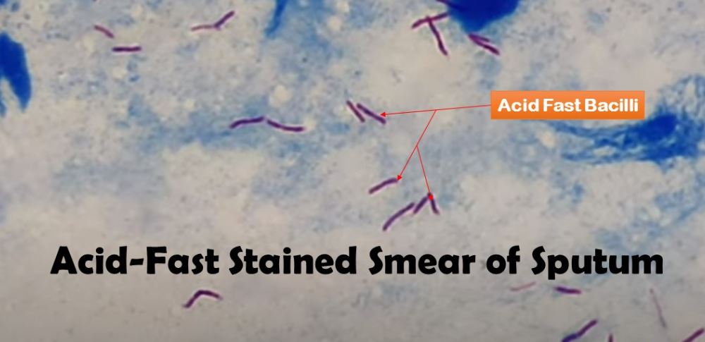AFB Stain