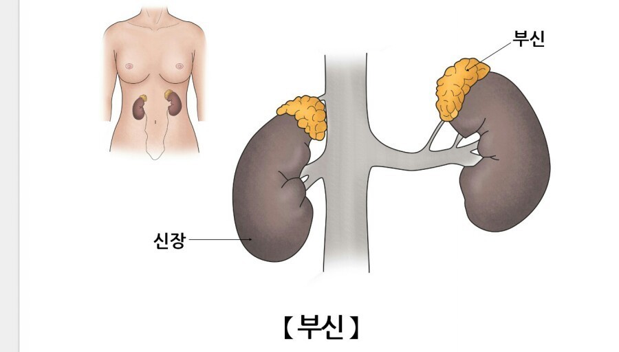 부신피질 호르몬제의 부작용
