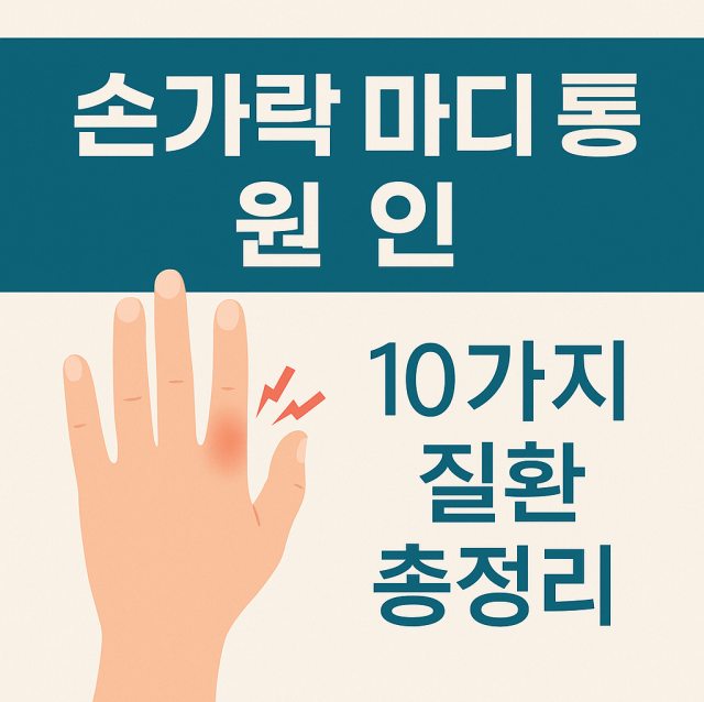 손가락 마디 통증의 10가지 주요 원인 질환을 설명하는 대표 이미지로 관절염, 퇴행성 질환 등 손 건강 문제를 강조한 그림