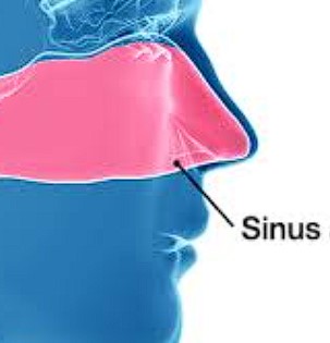상악동거상술-보험