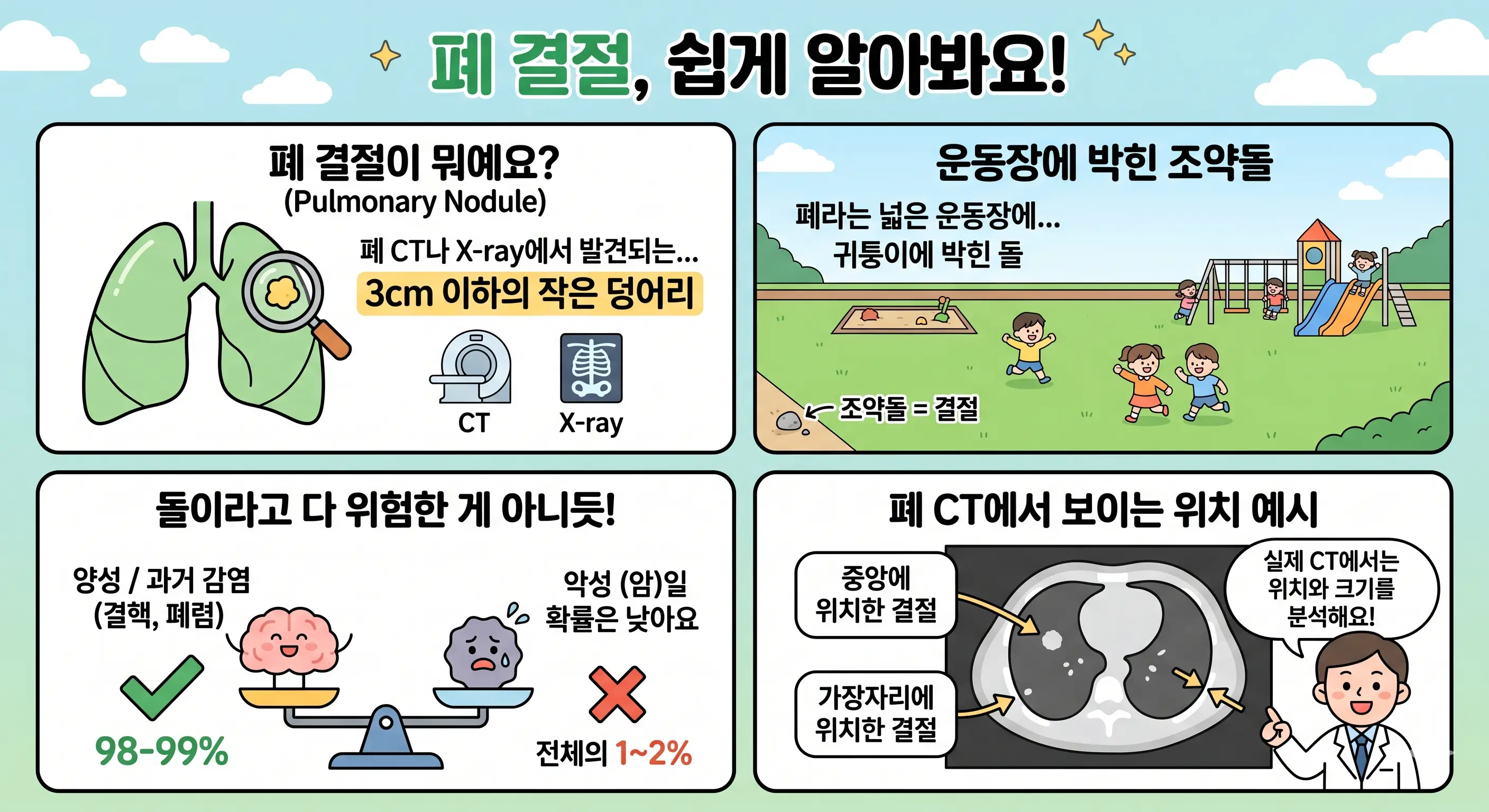 폐 결절