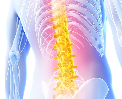 허리디스크 초기증상