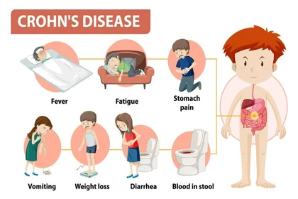 변비 증상과 원인에 따른 해결 방법 정리24