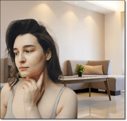 피부질환이 있는 여성