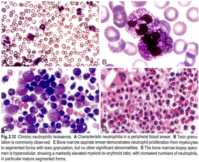 Neutrophil 수치