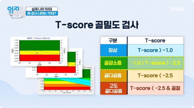 알약방 팽현숙 골다공증 영양제-3