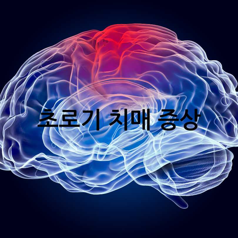 초로기 치매 증상과 자가진단법