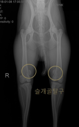 슬개골탈구/출처:어도비스톡