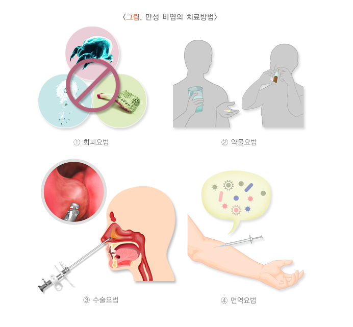 환절기 비염 예방법