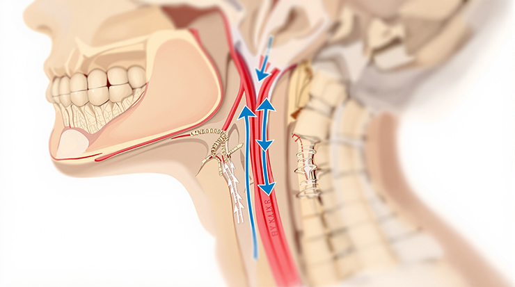 경동맥 부위를 표현한 일러트스 이미지