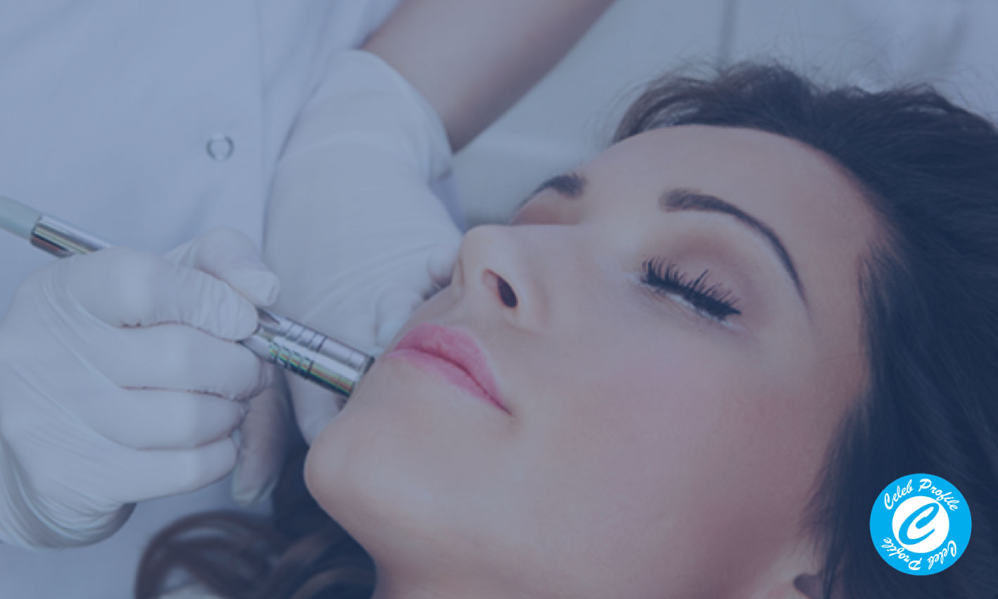 피부트러블 음식