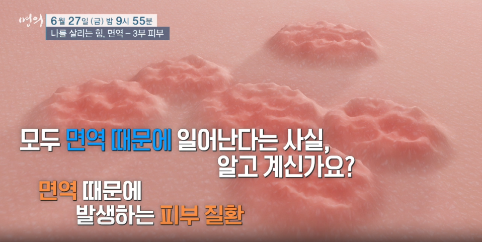 명의 나를살리는 힘 면역 3부 피부