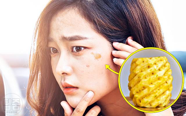피부 하얘지는 음식 피부미백에 좋은 음식 파인애플