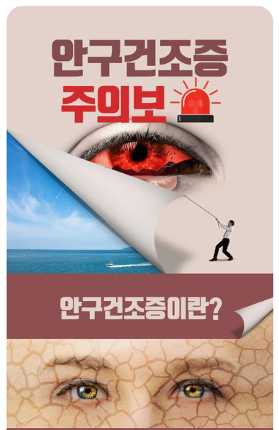 안구건조증-증상