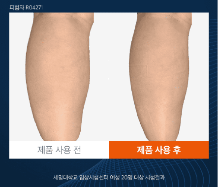 권은비 PICK 스파알 포터블 다리 종아리 마사지기 효과&amp;#44; 후기 (부모님 선물 추천)